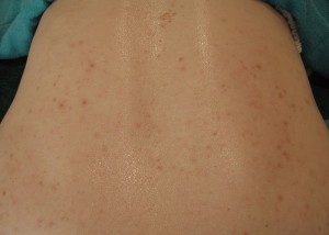 lamano1-1-before